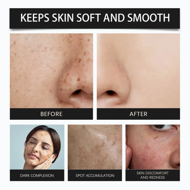 Brightening Moisturiz Face Cream Gentle Facial Skin Hydration Anti-aging Wrinkle Deep Health Whiten Exfoliation Serum Face Cream - Image 4