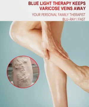 Varicose Vein Lampshade Therapy Effective Relief Of Dilated Vasculitis In The Legs Phlebitis Improved Blood Circulation New - Image 3