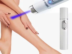 Varicose Vein Lampshade Therapy Effective Relief Of Dilated Vasculitis In The Legs Phlebitis Improved Blood Circulation New