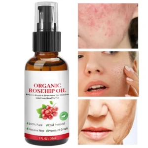 30ml Rosehip Oil Organic Rose Hips Face Oils Fast-Absorbing Skin Care Moisturizer Face Oil Organic Rosehip Seed Oil Essence - Image 4