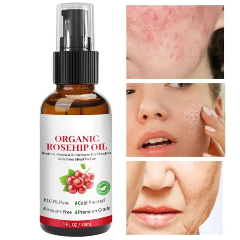 30ml Rosehip Oil Organic Rose Hips Face Oils Fast-Absorbing Skin Care Moisturizer Face Oil Organic Rosehip Seed Oil Essence - Image 4