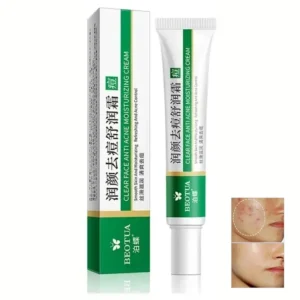 Herbal Acne Treatment Cream Face Scar Blackhead Remover Repair Gel Oil Control Shrink Pores Whitening Skin Care Korean Cosmetics - Image 7