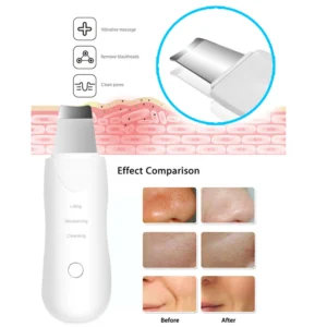 Ultrasonic Skin Scrubber Scrubber Deep Vibrate Facial Cleaner Shovel Face Scrubber Peeling Black Head Remover Facial Massager - Image 4