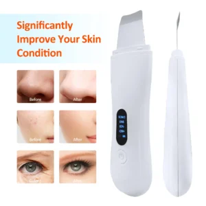 Ultrasonic Face Scrubber Deep Facial Peeling Machine Ultrasonic Skin Scrubber Blackhead Remover Acne Pore Face Cleaning Scrubber - Image 6