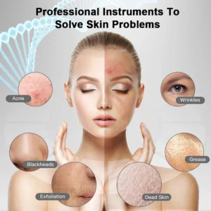 Ultrasonic Face Scrubber Deep Facial Peeling Machine Ultrasonic Skin Scrubber Blackhead Remover Acne Pore Face Cleaning Scrubber - Image 2