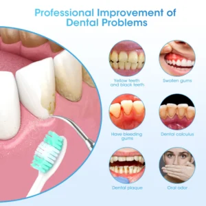 Electric Teeth Whitening Dental Calculus Scaler Plaque Coffee Stain Tartar Removal High Frequency Sonic Toothbrush Teeth Cleaner - Image 4