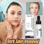 Dark Spots Remover Serum Powerful Removal Black Dot Melasma Chloasma Niacinamide Whitening Moisture Freckle Face Skin Care