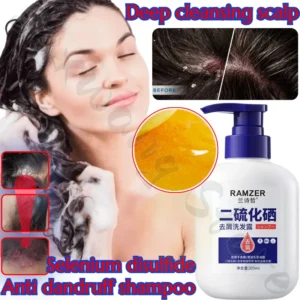 Selenium Disulfide Anti-Dandruff Shampoo Deep Cleansing Scalp Oil Control Anti-Dandruff Anti-Itching Smoothing Shampoo 320ml