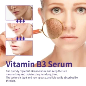 Hoygi Niacinamide Facial Serum Vitamin B3 Wrinkles Pigment Dark Spot Removal Correcting Glow Serum Face Whitening Moisturizer - Image 5
