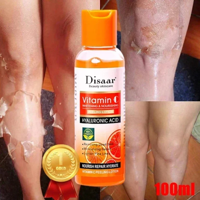 Yellow Peeling Lotion Oil 100% Organic Bleaching Dark Skin Exfoliating Whitening Nourishing Hyaluronic Acid Moisturiz Body Scrub - Image 3