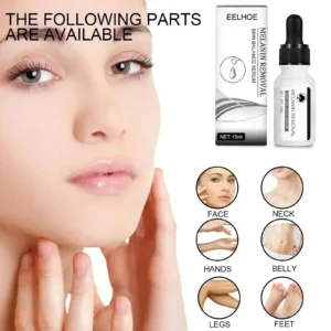 Dark Spots Remover Serum Powerful Removal Black Dot Melasma Chloasma Niacinamide Whitening Moisture Freckle Face Skin Care - Image 3