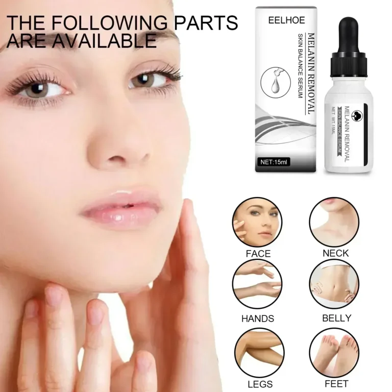 Dark Spots Remover Serum Powerful Removal Black Dot Melasma Chloasma Niacinamide Whitening Moisture Freckle Face Skin Care - Image 3