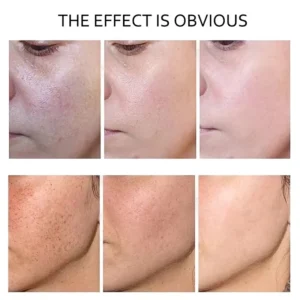 Dark Spot Correcting Face Serum Anua 10% Niacinamide+ 4% Tranexamic Acid Whitening Moisturizing Brighten Glow Korean Skin Care - Image 3