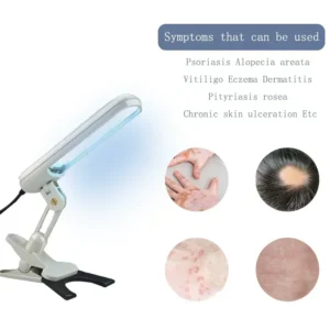 Get Clear Skin with UVB Phototherapy Narrow 311nm UV Lamp: Ideal for Psoriasis and Vitiligo - Image 3