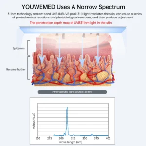 YOUWEMD 311NM UVB Phototherapy Lamp Device for Vitiligo With Timer Treatment UV NarrowBand Ultraviolet Light Therapy Psoriasis - Image 3