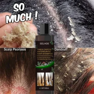 100ml Eelhoe Shampoo Anti-Itching Shampoos Anti-Dandruff Anti-Itching Shampoo Anti-Shedding Refreshing Shampoo Profissional