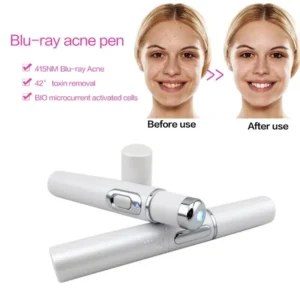 Blue Light Facial Machine Acne Wrinkle Removal Laser Pen Skin Spots Removal Anti Varicose Spider Vein Eraser Medical Treatment - Image 4