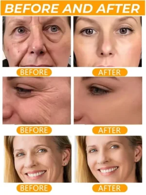 Hyaluronic Acid Instant Wrinkle Remover Essence Fade Fine Lines Face Serum Anti Aging Firming Lifting Whitening Korean Skin Care - Image 2