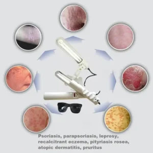 UV 311nm Ultraviolet Phototherapy Device Uses Philips Lamp UVB To Treat Vitiligo, Psoriasis, White Spots And Skin Diseases - Image 6