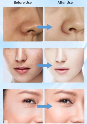 Hoygi Niacinamide Facial Serum Vitamin B3 Wrinkles Pigment Dark Spot Removal Correcting Glow Serum Face Whitening Moisturizer - Image 3