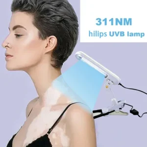 Household UVB 311nm phototherapy ultraviolet rays for leukemia, psoriasis, eczema, dermatitis, skin problem treatment 110V/220V - Image 2