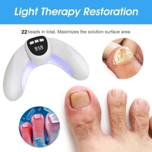 Nail Fungal Light Device Fungal Discolored Remover Portable Nail Fungal Eradication Device for Thick Toenails and Fingernails - Image 6