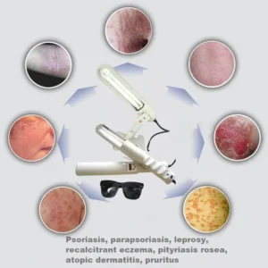 Household UVB 311nm phototherapy ultraviolet rays for leukemia, psoriasis, eczema, dermatitis, skin problem treatment 110V/220V - Image 3
