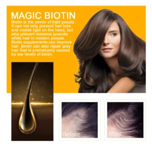 Magic Biotin Hair Serum Strengthen Smoothing Deep Nourishing Frizzy Hair Product Damaged Repair Spray Hair Oil Serum Scaclp Care - Image 3