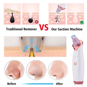 Blackhead Remover Diamond Dermabrasion Nose Vacuum Pore Cleanser Acne Pimple Suction Extractor USB Rechargeable Skin Care Tool - Image 3