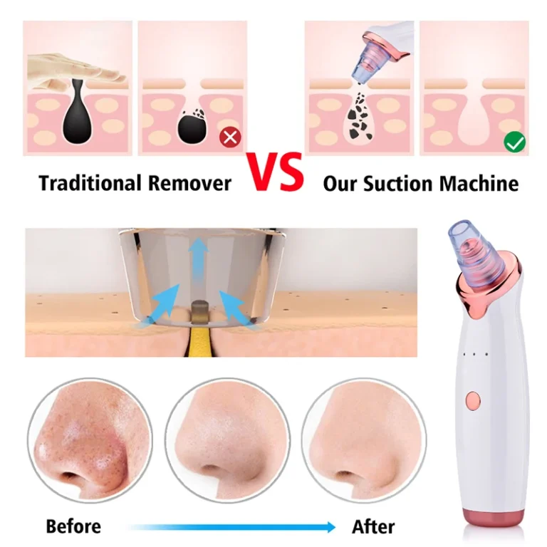 Blackhead Remover Diamond Dermabrasion Nose Vacuum Pore Cleanser Acne Pimple Suction Extractor USB Rechargeable Skin Care Tool - Image 3