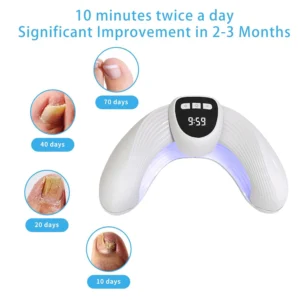 Nail Fungal Light Device Fungal Discolored Remover Portable Nail Fungal Eradication Device for Thick Toenails and Fingernails - Image 5