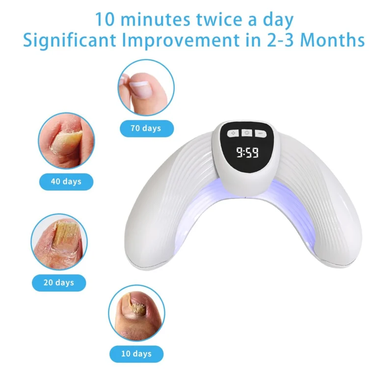 Nail Fungal Light Device Fungal Discolored Remover Portable Nail Fungal Eradication Device for Thick Toenails and Fingernails - Image 5