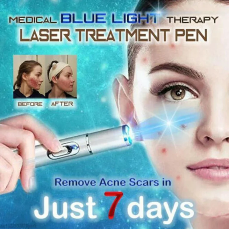 Laser therapy Keloid scar Laser Therapy Leg Repair Pen Reduce Legs Imcomfortable Improving Blood Circulation Varicose Veins Pen - Image 4