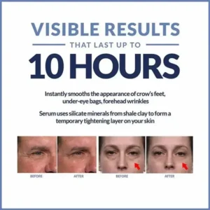 Instant Eye Cream For Anti Aging Dark Circles Bags Puffiness Great Under Eye Skin Face Tightening Eye Lift Treatment Care - Image 5