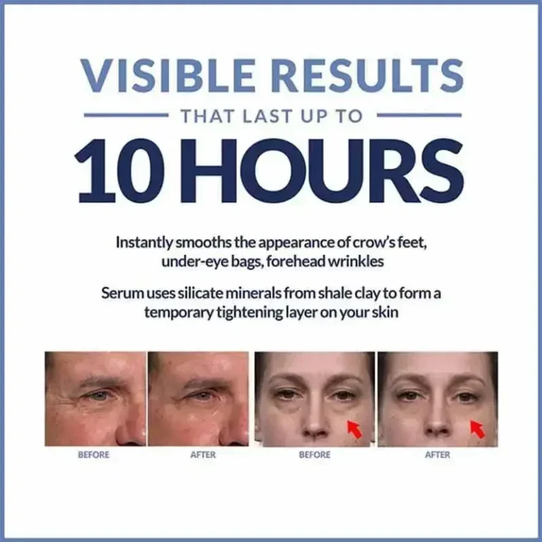 Instant Eye Cream For Anti Aging Dark Circles Bags Puffiness Great Under Eye Skin Face Tightening Eye Lift Treatment Care - Image 5
