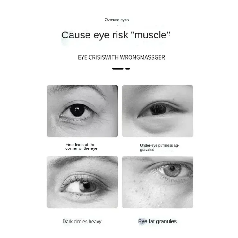 Eye Massager EMS Pulse Microcurrent Relief Relieve Fatigue Massage To Reduce Dark Circles Lines Swelling Anti-Wrinkle skin care - Image 3