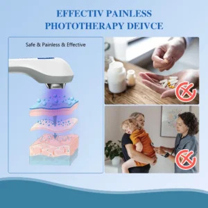 308nm Household Ultraviolet Phototherapy Instrument, Vitiligo Treatment, UVB Lamp Laser for Therapy, Psoriasis, Skin Disease - Image 3