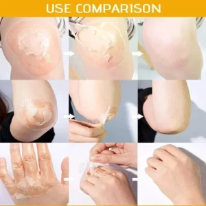 Yellow Peeling Lotion Oil 100% Organic Bleaching Dark Skin Exfoliating Whitening Nourishing Hyaluronic Acid Moisturiz Body Scrub - Image 4
