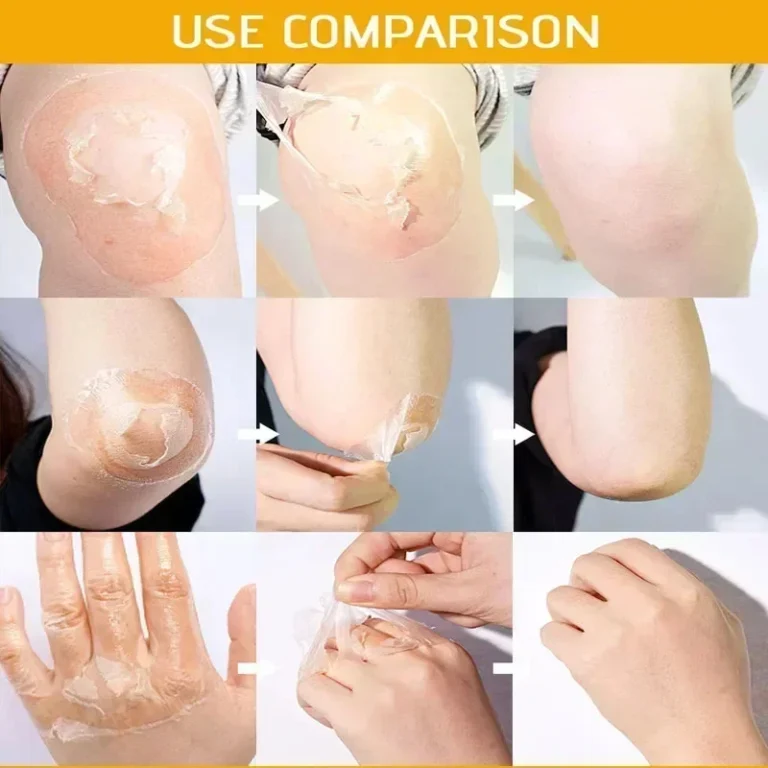 Yellow Peeling Lotion Oil 100% Organic Bleaching Dark Skin Exfoliating Whitening Nourishing Hyaluronic Acid Moisturiz Body Scrub - Image 4