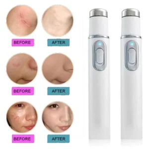 Blue Light Facial Machine Acne Wrinkle Removal Laser Pen Skin Spots Removal Anti Varicose Spider Vein Eraser Medical Treatment - Image 3