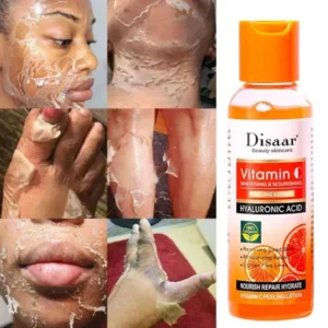 Yellow Peeling Lotion Oil 100% Organic Bleaching Dark Skin Exfoliating Whitening Nourishing Hyaluronic Acid Moisturiz Body Scrub - Image 2