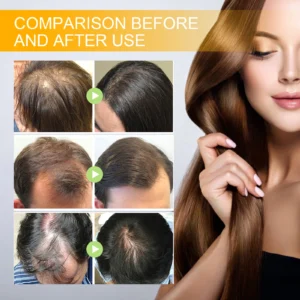 Magic Biotin Hair Serum Strengthen Smoothing Deep Nourishing Frizzy Hair Product Damaged Repair Spray Hair Oil Serum Scaclp Care - Image 2