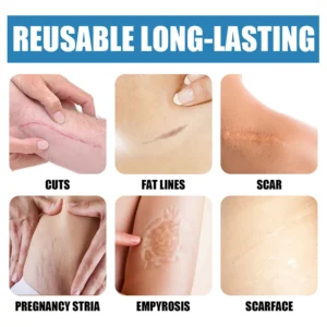 Laser therapy Keloid scar Laser Therapy Leg Repair Pen Reduce Legs Imcomfortable Improving Blood Circulation Varicose Veins Pen - Image 5