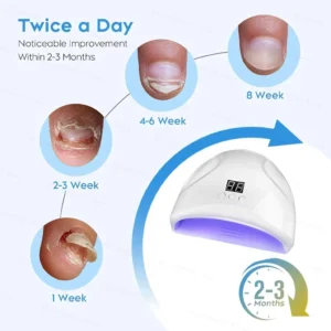 Nail Fungal Laser Treatment Device Repair Anti Infection Paronychia Onychomycosis Ingrown Toenail Foot Care Essence - Image 5