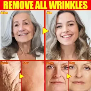 Hyaluronic Acid Instant Wrinkle Remover Essence Fade Fine Lines Face Serum Anti Aging Firming Lifting Whitening Korean Skin Care - Image 5
