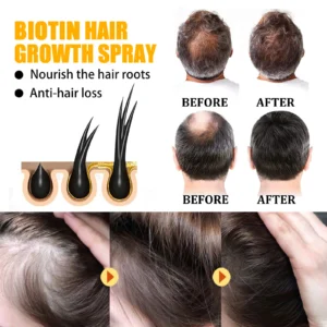 Magic Biotin Hair Serum Strengthen Smoothing Deep Nourishing Frizzy Hair Product Damaged Repair Spray Hair Oil Serum Scaclp Care - Image 5