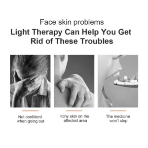 Uvb Lamp Vitiligo Physical Therapy Equipment Narrowband Light Lamp Medical Light Source UV 311nm Therapy For Psoriasis Eczema - Image 4