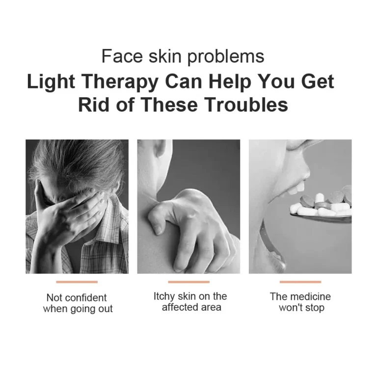 Uvb Lamp Vitiligo Physical Therapy Equipment Narrowband Light Lamp Medical Light Source UV 311nm Therapy For Psoriasis Eczema - Image 4