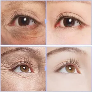 Instant Eye Cream For Anti Aging Dark Circles Bags Puffiness Great Under Eye Skin Face Tightening Eye Lift Treatment Care - Image 3