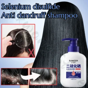 Selenium Disulfide Anti-Dandruff Shampoo Deep Cleansing Scalp Oil Control Anti-Dandruff Anti-Itching Smoothing Shampoo 320ml - Image 2